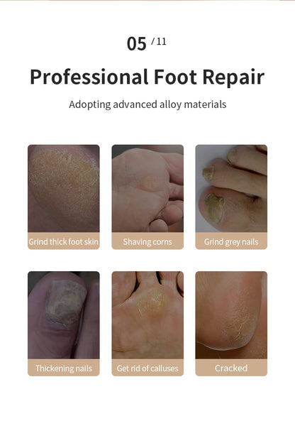 Soleva™ — Electric Foot Care